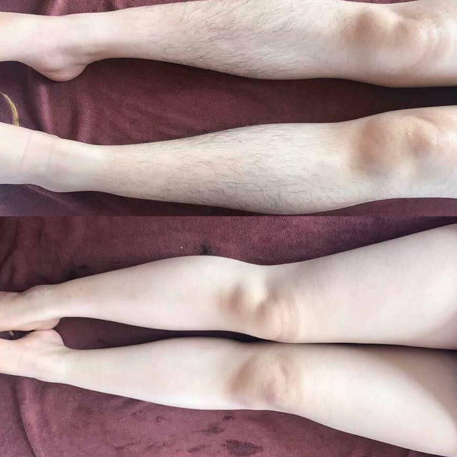 Kem Tẩy Lông Huyền Phi [ Mua 1 Tặng 1 Serum] triệt lông tận gốc, lông nách, lông bikini, ria mép, râu,triệt mùi hôi nách | BigBuy360 - bigbuy360.vn