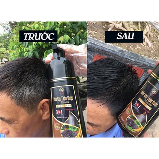 DẦU GỘI THẢO DƯỢC ĐEN TÓC