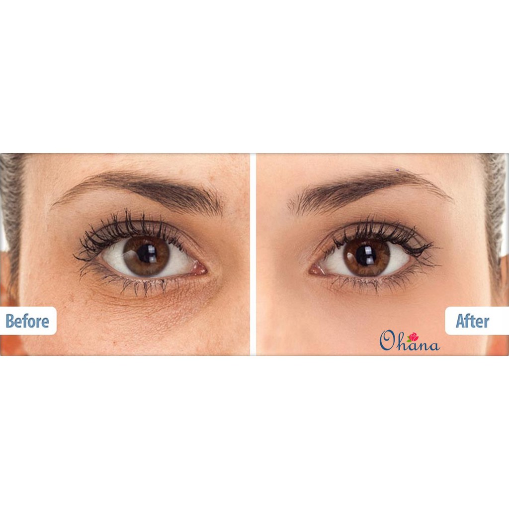 Kem Dưỡng Giảm Bọng Mắt, Nếp Nhăn Balance Active Formula Snake Venom Anti-Ageing Cream 15ml | BigBuy360 - bigbuy360.vn