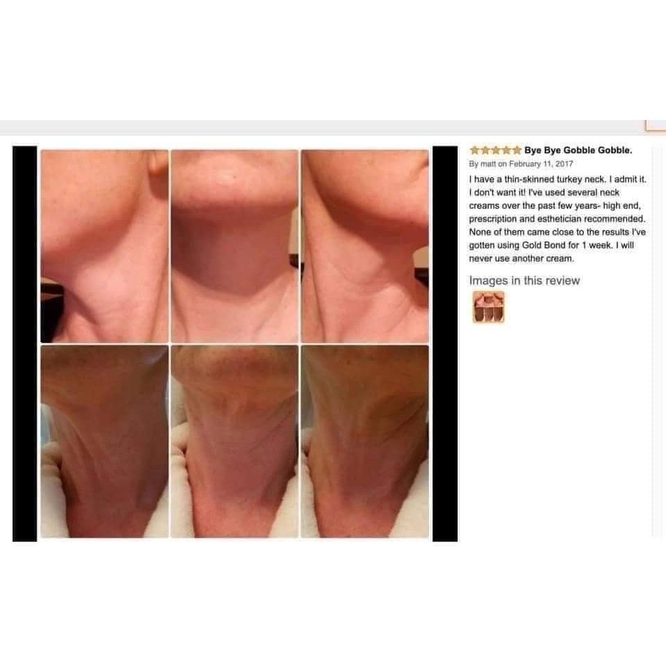 Gold Bond Neck & Chest Firming Cream Kem săn chắc vùng cổ -ngực SALE !! | BigBuy360 - bigbuy360.vn