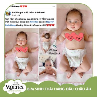 Bỉm/Tã quần Moltex XL (cho bé 14-20KG) 18 miếng