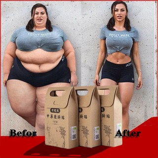  Bộ 10 miếng detox dán rốn hỗ trợ giảm cân đốt mỡ thừa