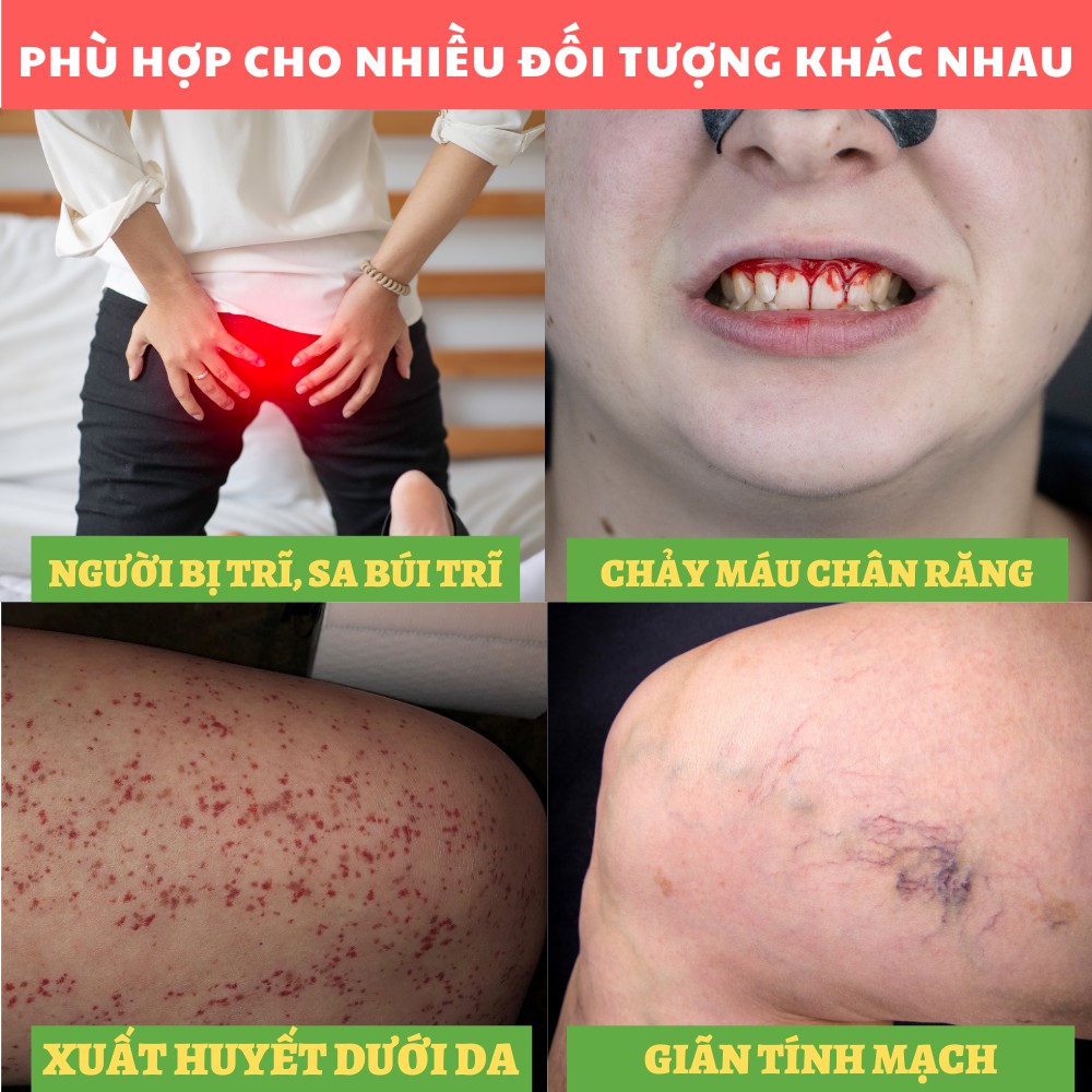 Rutin C - Rutin C - Hỗ trợ làm giảm suy giãn tĩnh mạch trực tràng ở người bị trĩ, sa búi trĩ (Hộp 30 viên)