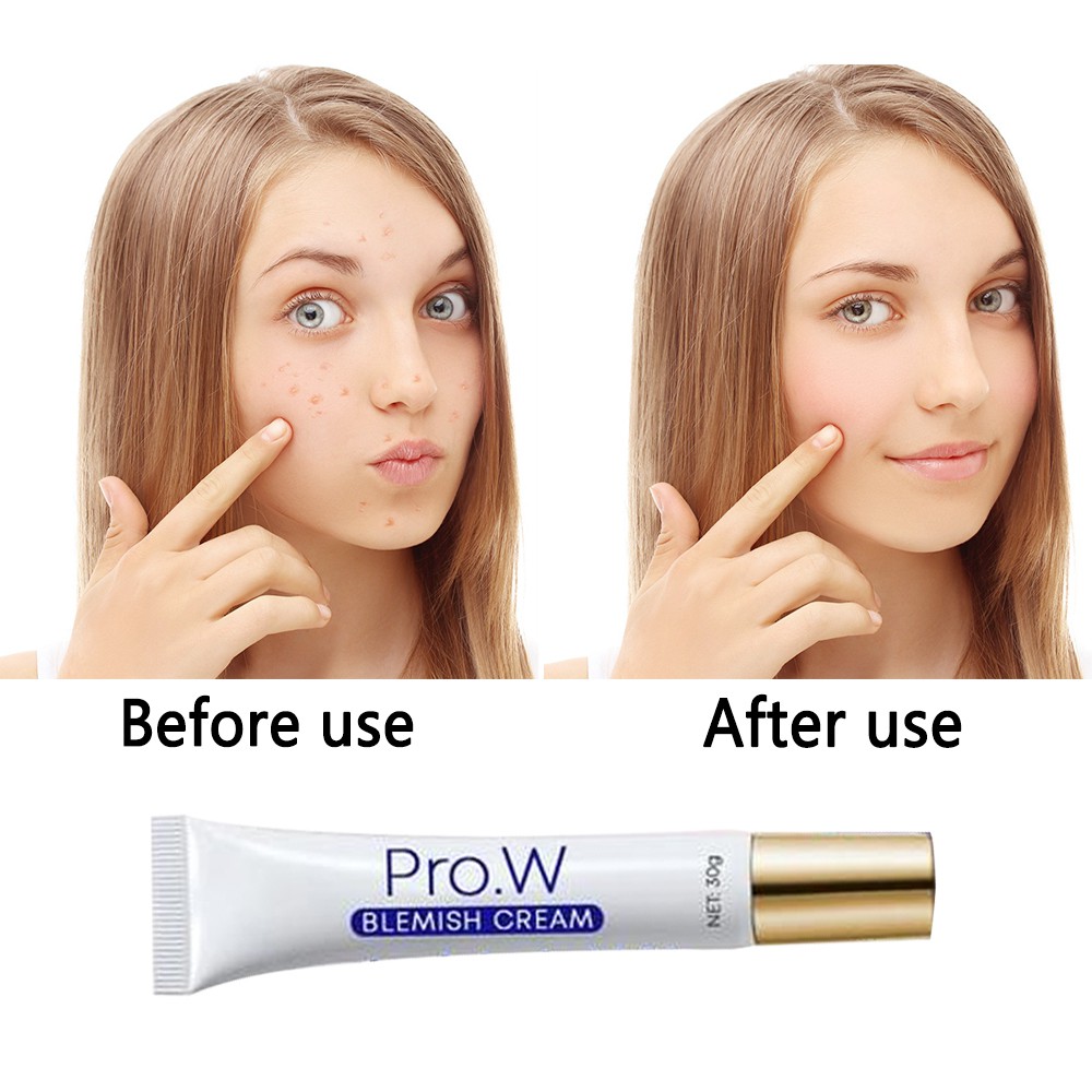 COD Pro.W  Acne Cream Anti-acne Cream Water-oil Balance Acne Cream Moisturizing Skin Cream Blemish Cream vanilla