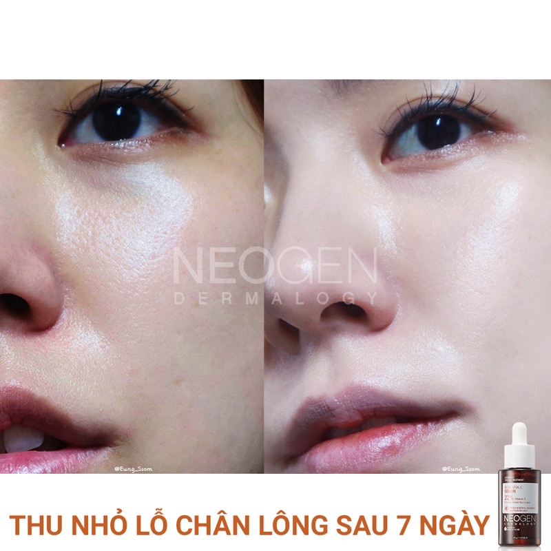 Tinh chất sáng da mờ thâm NEOGEN DERMALOGY REAL VITA C SERUM