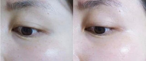 MẶT NẠ MẮT PRRETI REAL VITA EYEZONE PATCH