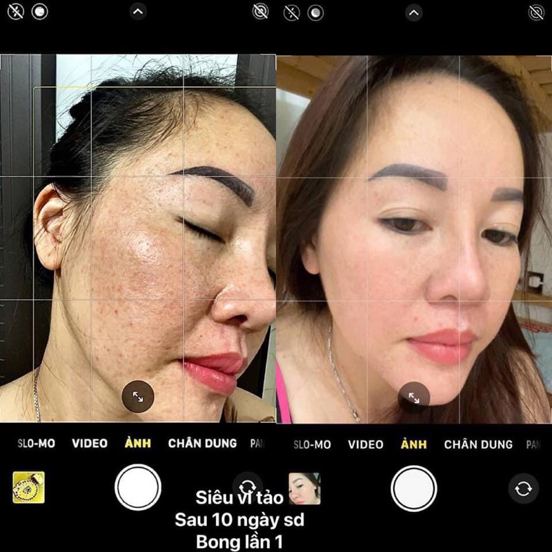 Serum tái sinh da siêu vi tảo Nhật | BigBuy360 - bigbuy360.vn