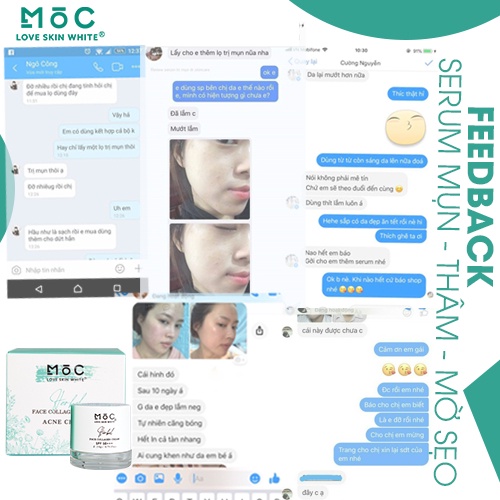 Kem dưỡng ngăn ngừa mụn thâm Collagen Love Skin White Mộc 20g