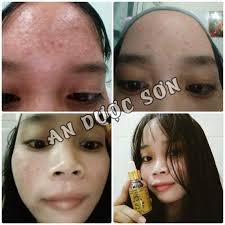 Combo 3 Bột An Dược Sơn 100gr - Bột rửa mặt