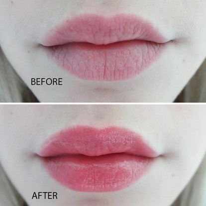 Son Dưỡng Môi Vaseline Mùi Hoa Hồng Lip Therapy Rosy Lips 7g - 2016 Skincare