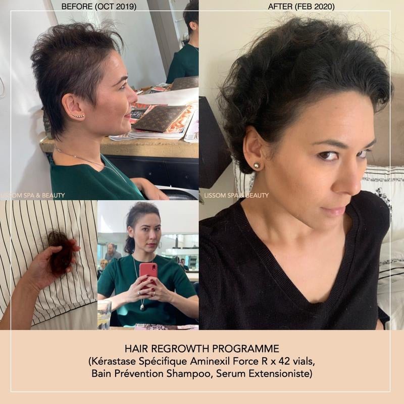 Huyết thanh chống rụng và mọc tóc KERASTASE CURE ANTI CHUTE Specifique   10x6ml