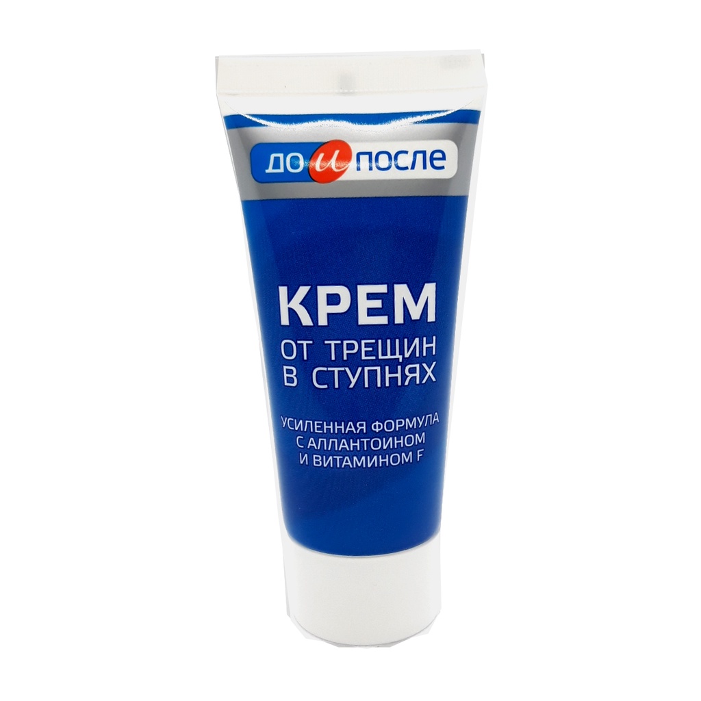 [ Hàng Chính Hãng] Kem Nứt Gót Chân Kpem Nga 50ml