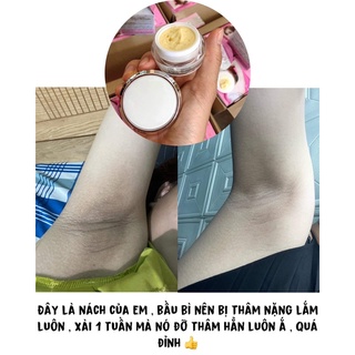 Kem Thâm Nách Qnic