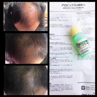 Huyết thanh kích mọc tóc Sato 30ml