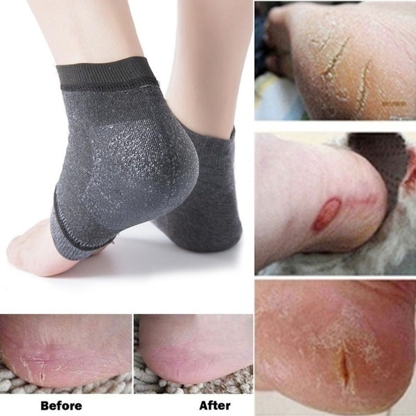 Set 2 chiếc vớ silicon bảo vệ gót chân