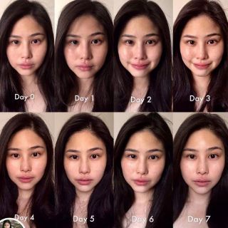 TINH CHẤT VITAMIN C NGUYÊN CHẤT CLINIQUE