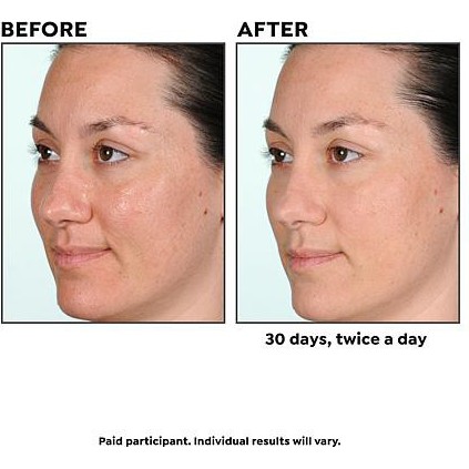 Serum tinh chất trẻ hóa da Lancome Advanced Genifique Youth Activating Concentrate