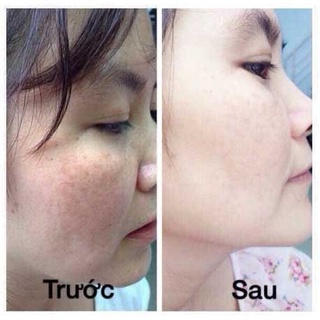 [5ml-50ML ] Thuốc Bắc Tái Tạo Da