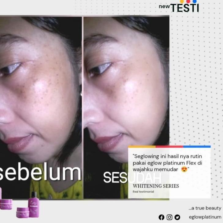 Pkd-557|⭐ Đai Nịt Bụng Và busui Bạch Kim An Toàn Cho Mẹ Bầu⭐Xe tăng | BigBuy360 - bigbuy360.vn