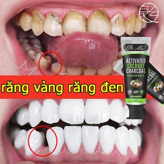 kem đánh răng dừa  PEIMEI Kem Đánh Răng  Giúp Làm Trắng Răng Tự Nhiên Sau 2 Tuần Với Chiết Xuất Dừa Và Than Hoạt Tính