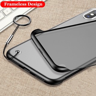 Ốp điện thoại kiểu dáng thời trang thích hợp cho Iphone 11 6 S 7 8 Plus Xr X Xs 11 Pro Max