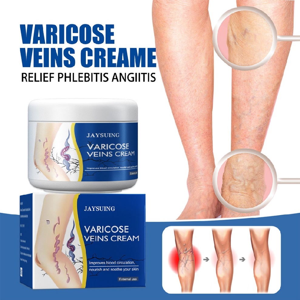 50g Vein Care Fading Cream Varicose Veins Cream for Legs Veins Herbal Ointment