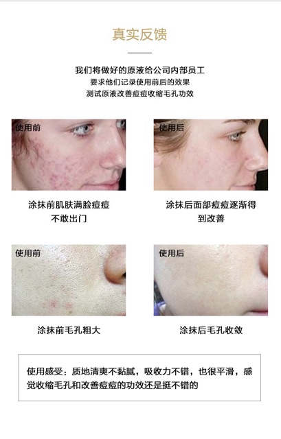 Tinh chất huyết thanh Tế bào gốc tươi ống 10ml | BigBuy360 - bigbuy360.vn