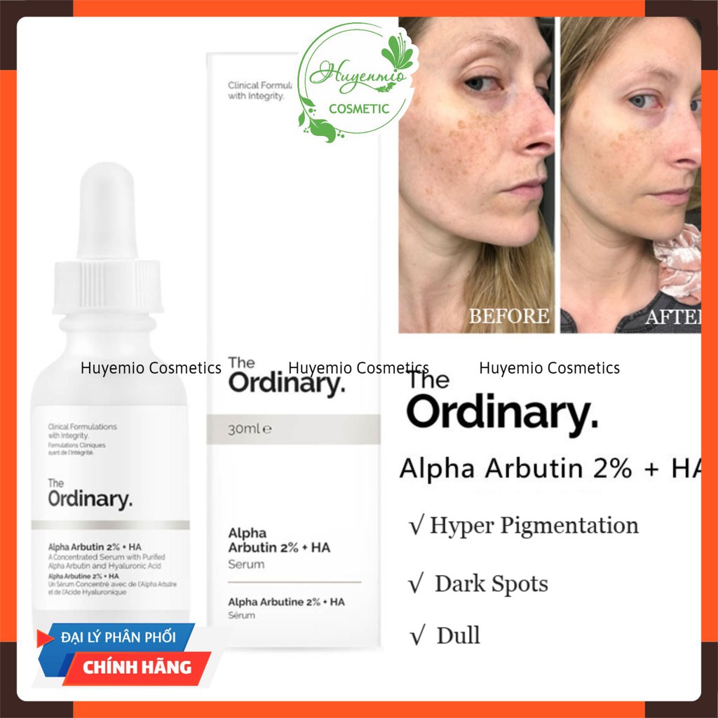 The Ordinary Niacinamide 10% + Zinc 1% Tinh chất giảm mụn thâm - 30ml [CHÍNH HÃNG] | BigBuy360 - bigbuy360.vn