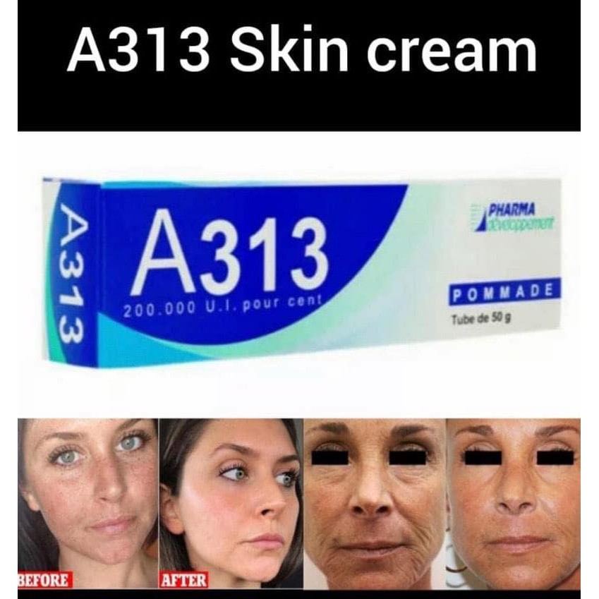 Kem Retinol A313