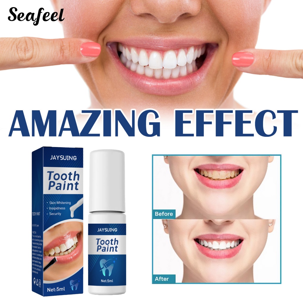 Sf_dây Sơn Trắng Răng Gọn Nhẹ Làm Trắng Răng Miệng
