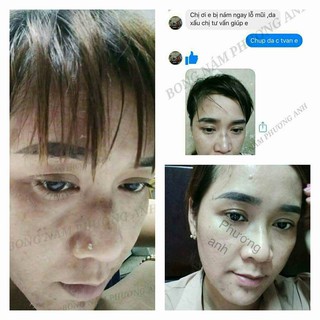 BONG NÁM PHƯƠNG ANH