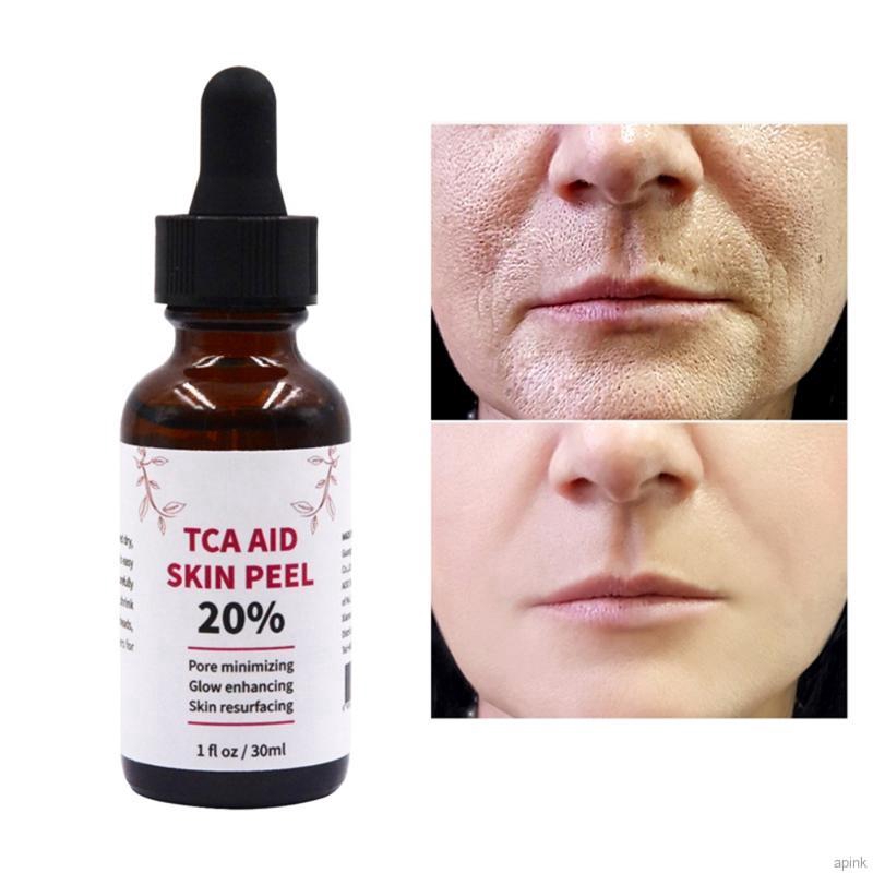 Serum Chứa 20% Axit Hyaluronic Thu Nhỏ Lỗ Chân Lông Xóa Nếp Nhăn Và Đốm Thâm Hiệu Quả 30ml