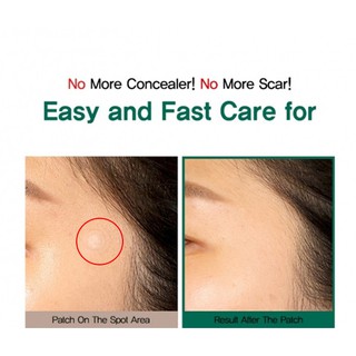 Miếng Dán Mụn Some By Mi Clear Spot Patch
