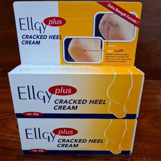 Kem bôi Nứt Gót Chân Ellgy Plus 25g