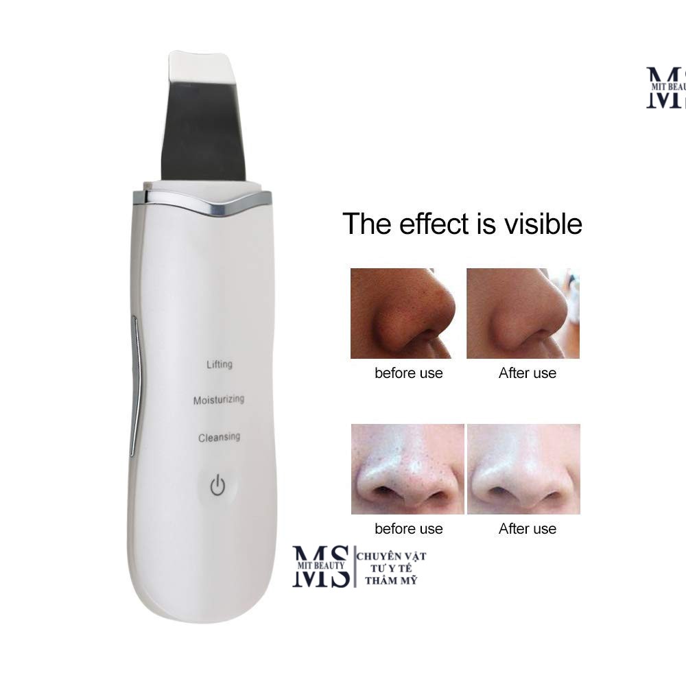 Máy cà da, sủi da tại nhà ultrasonic shovel làm sạch sâu phiên bản mới Hàn Quốc