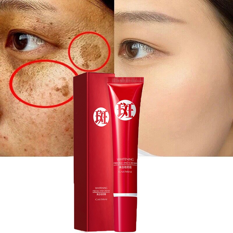 Kem Làm Trắng Và Loại Bỏ Các Hắc Tốt Melanin Và Chăm Sóc Da Trắng Sáng Tự Nhiên Kem Chăm