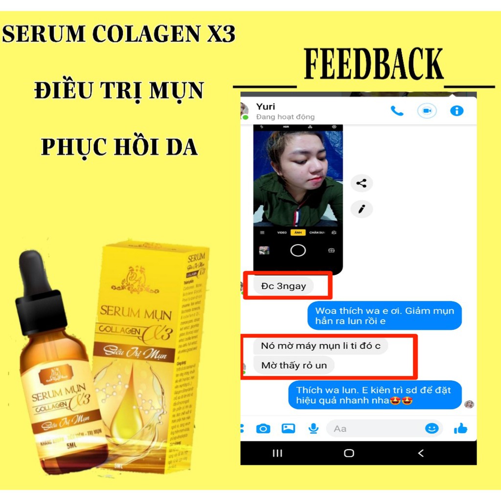 Serum mụn Collagen X3