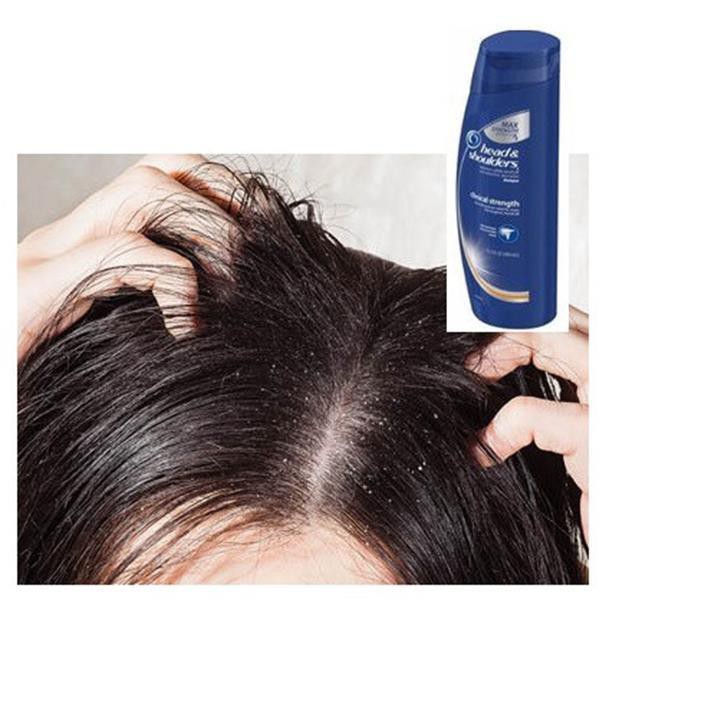 DẦU GỘI HEAD AND SHOULDER CLINICAL STRENGTH 400ML CỦA MỸ | BigBuy360 - bigbuy360.vn