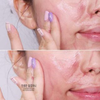 Serum thay da RED PEEL TINGLE SERUM