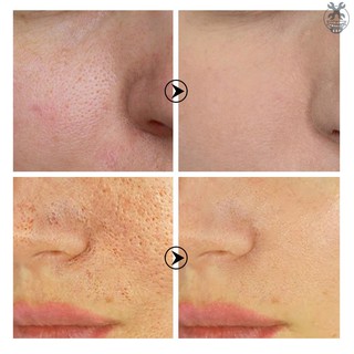 Tinh Chất Dưỡng Ẩm Chăm Sóc Da