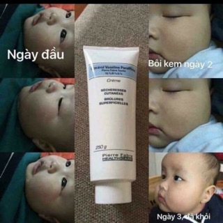 Kem dưỡng da trị nẻ cho bé Dexeryl