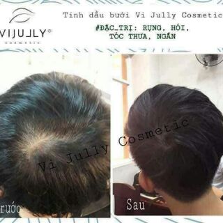 (Mua 2 Free ship) Tinh dầu bưởi - Giúp Mọc Tóc_ Làm Dài Tóc