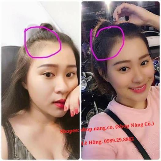 TINH DẦU BƯỞI KÍCH MỌC TÓC dày và dài, Giảm RỤNG TÓC, chống hói đầu, Giảm khô xơ, Dưỡng mềm mượt, sạch gàu