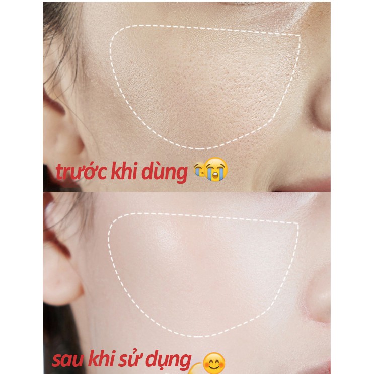 [SỈ ] Serum Heyxi Tinh Chất Se Lỗ Chân Lông   LYSHOP | BigBuy360 - bigbuy360.vn
