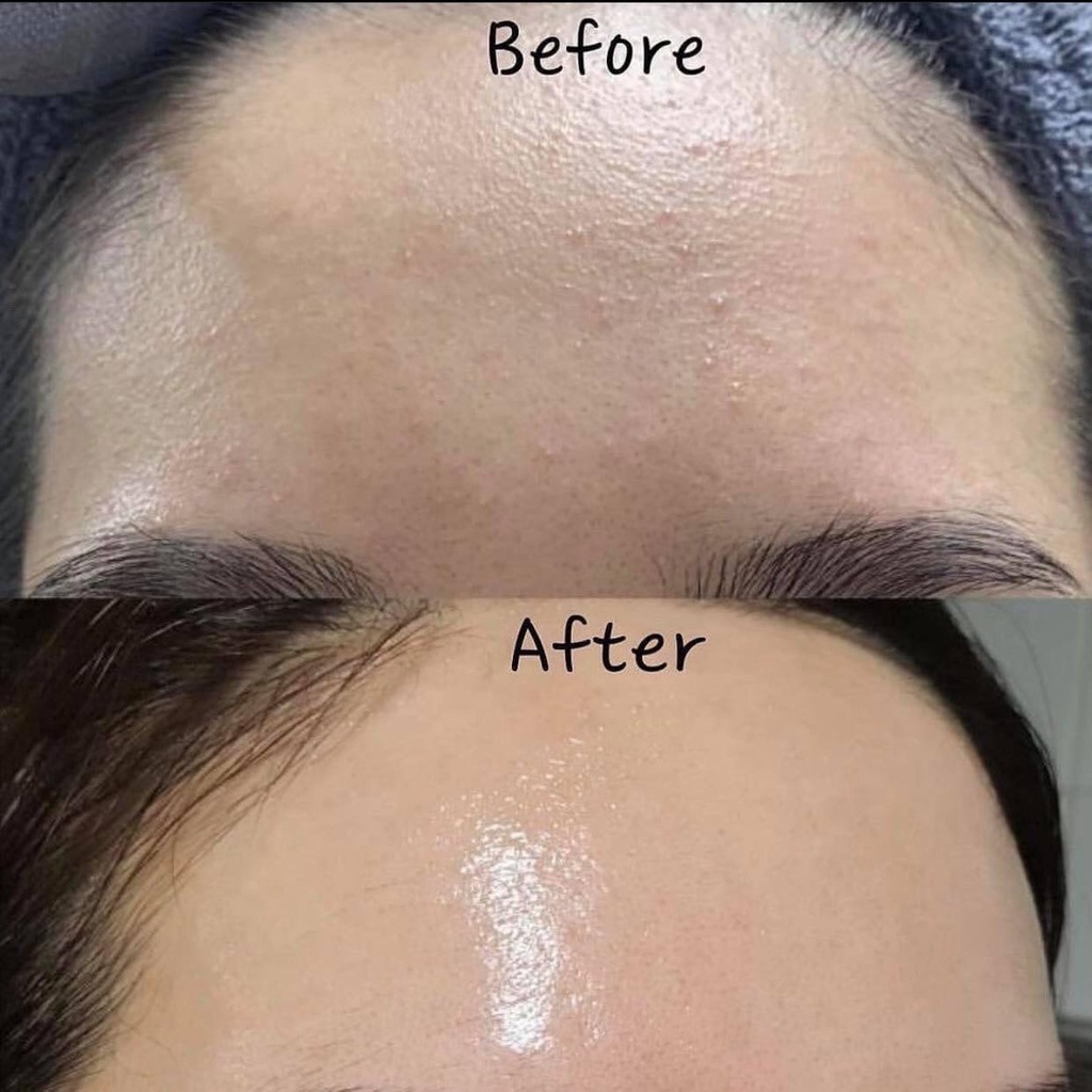 E98_Serum Vitamin B5 10% của Vlenn