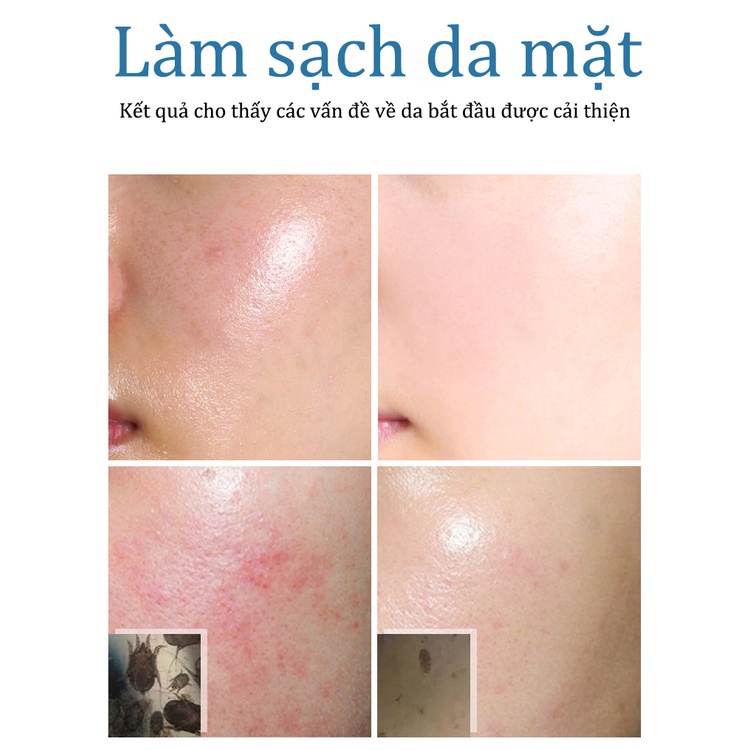 Sữa rửa mặt axit amin, Kiểm soát dầu và mụn Sữa rửa mặt[150ml], Làm sạch chuyên sâu, Soảng khoái nẩy da, Căn bằng nước và dầu, dưỡng ẩm làm trắng, thu nhỏ lỗ chân lông, kiểm soát dầu, mụn, da mẫn cảm cũng có thể sử dụng