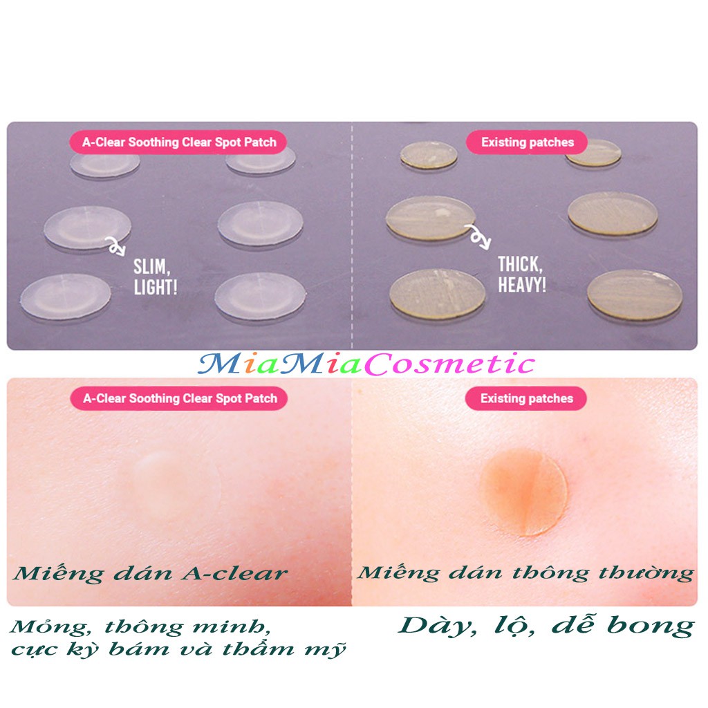 Miếng Dán Mụn Neogen Dermalogy A-Clear Soothing Spot Patch 24 Miếng 2 Kích Thước Bám Dính Cực Tốt [NHẬP KHẨU CHÍNH HÃNG]