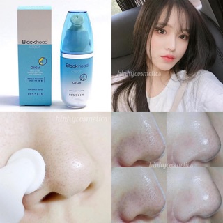 GEL cải thiện MỤN ĐẦU ĐEN IT'S SKIN