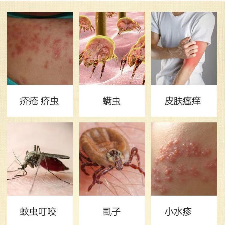 Thuốc Mỡ Lưu Huỳnh Trung Bình 20% Trị Ngứa Và Thắt Nút Chống Ngứa Da