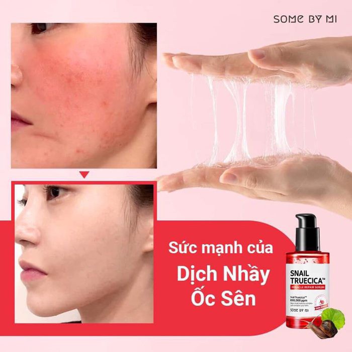 Tinh Chất Dưỡng Phục Hồi, Cải Thiện Vết Thâm, Sẹo, Làm Dịu Da Some By Mi Snail Truecica Miracle Repair Serum 50ml